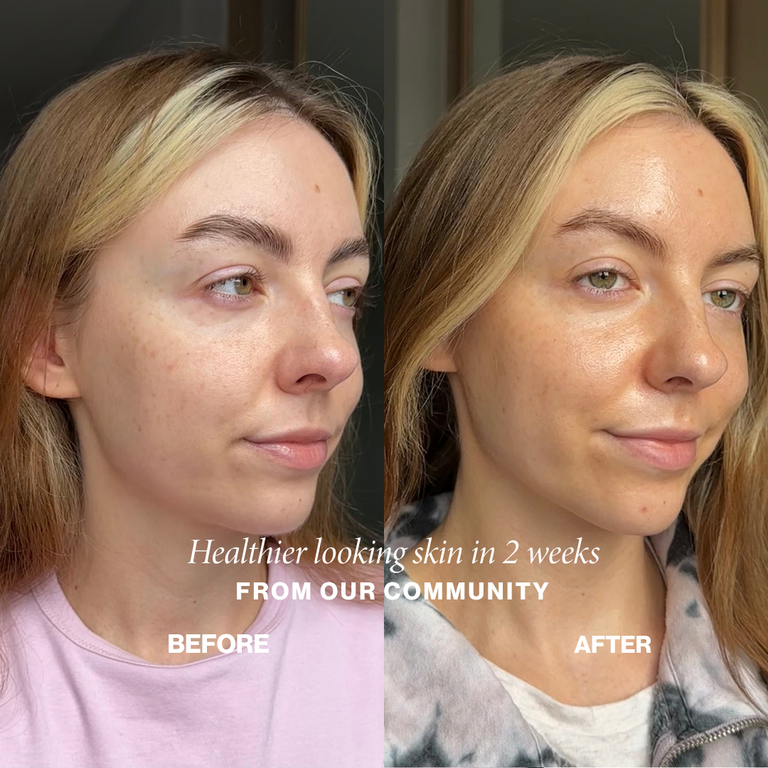 Community before and after: healthier-looking, dewier skin in 2 weeks with Face Fog