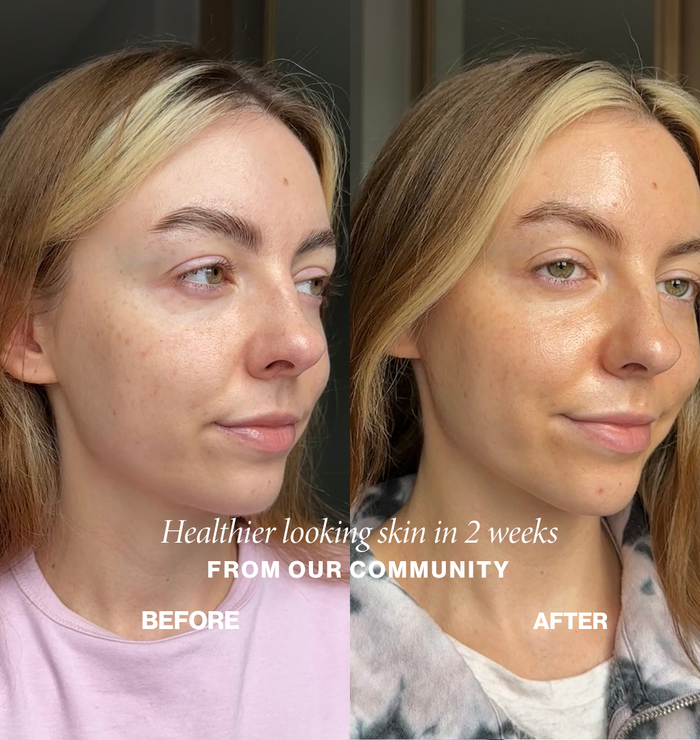 Community before and after: healthier-looking, dewier skin in 2 weeks with Face Fog