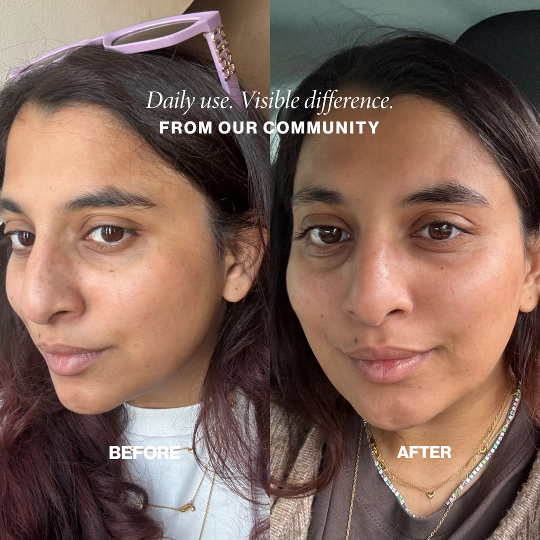 Community before and after: brighter, more hydrated skin with daily Face Fog