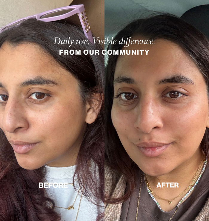 Community before and after: brighter, more hydrated skin with daily Face Fog