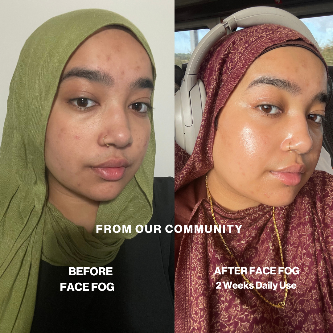 Community before and after: skin looks more even and glowing after 2 weeks of daily Face Fog
