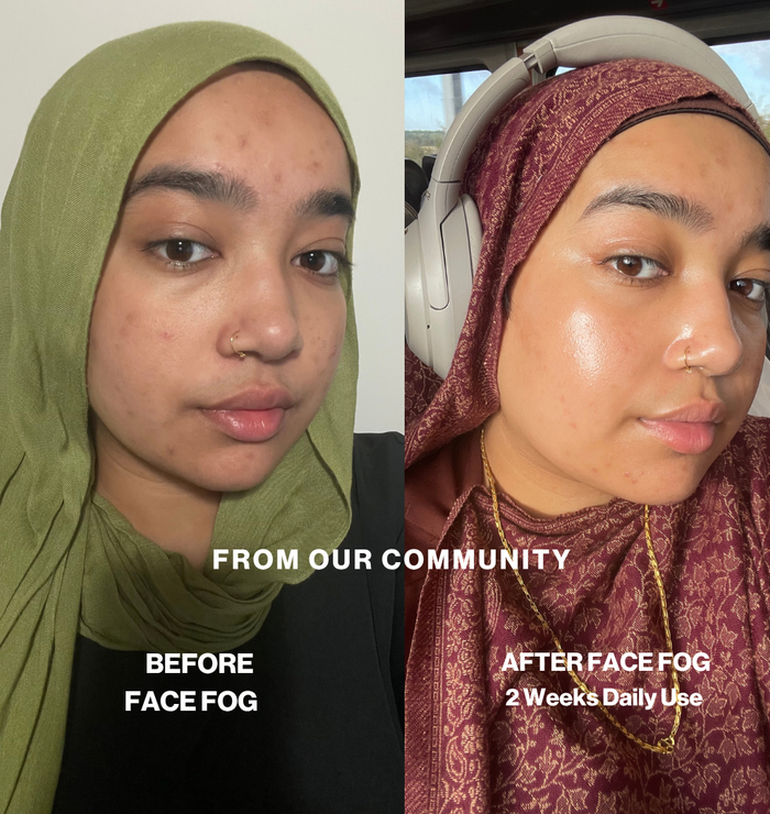 Community before and after: skin looks more even and glowing after 2 weeks of daily Face Fog